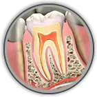 bastrop root canal - Spring St. Dental | Dr Romney & Dr Lasson