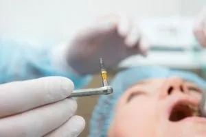 dental implant procedure - Spring St. Dental | Dr Romney & Dr Lasson