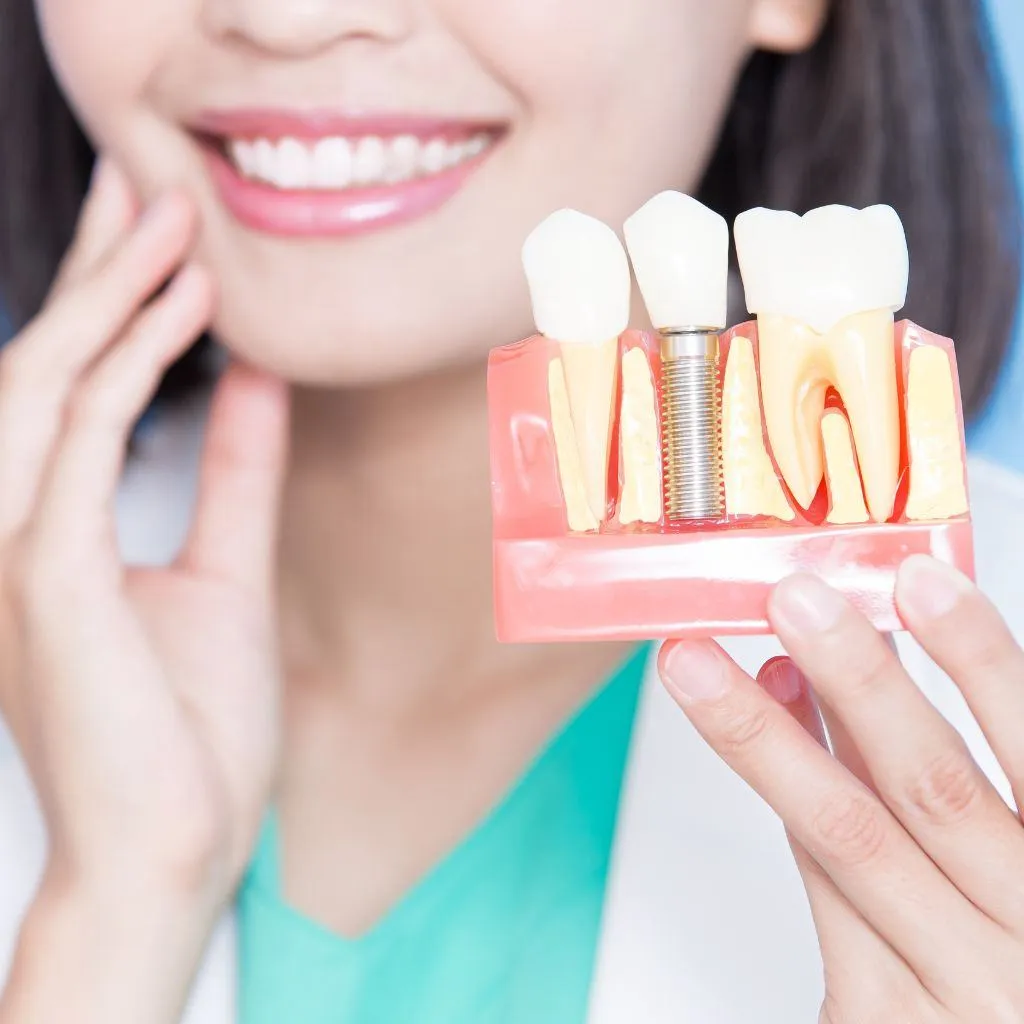 doctor showing a dental implant - Spring St. Dental | Dr Romney & Dr Lasson