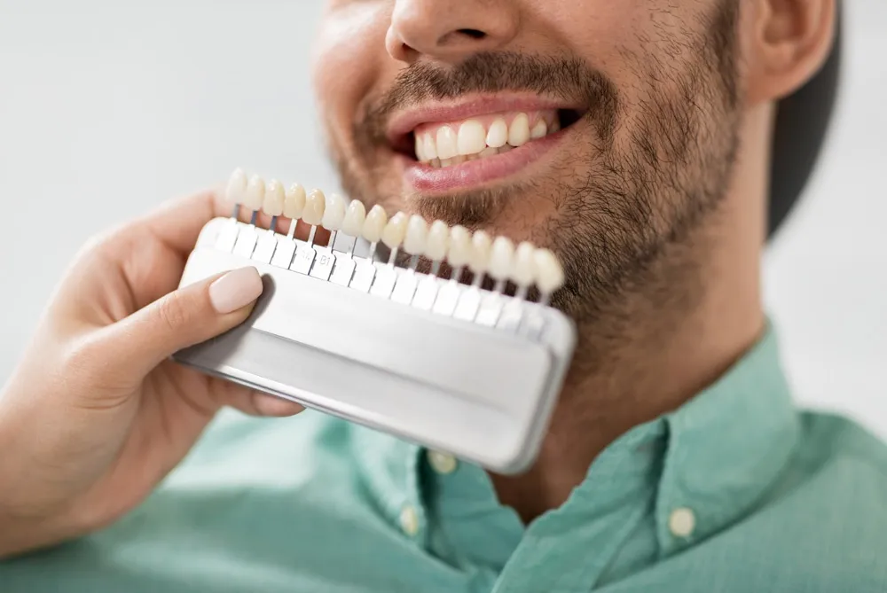 Are Veneers or Implants Best for Your Smile Makeover?
