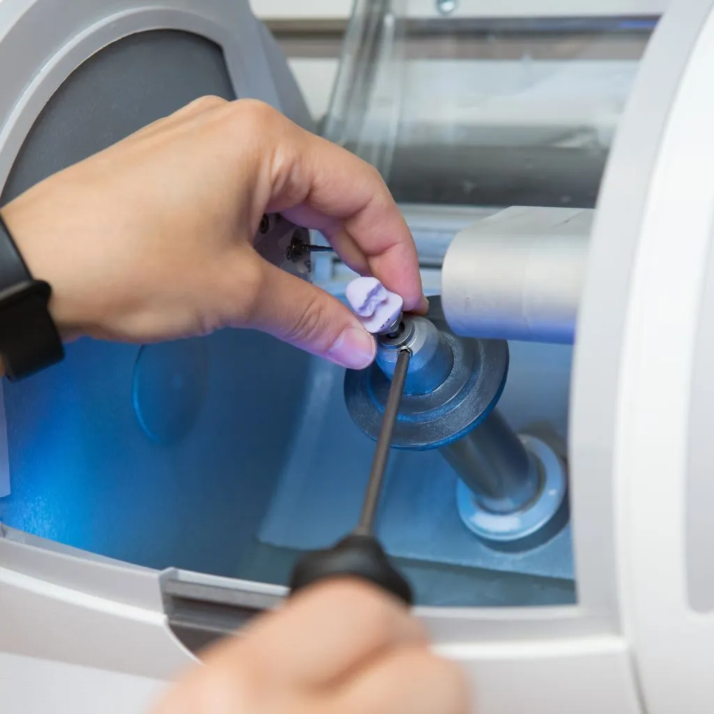 cerec crown - Spring St. Dental | Dr Romney & Dr Lasson