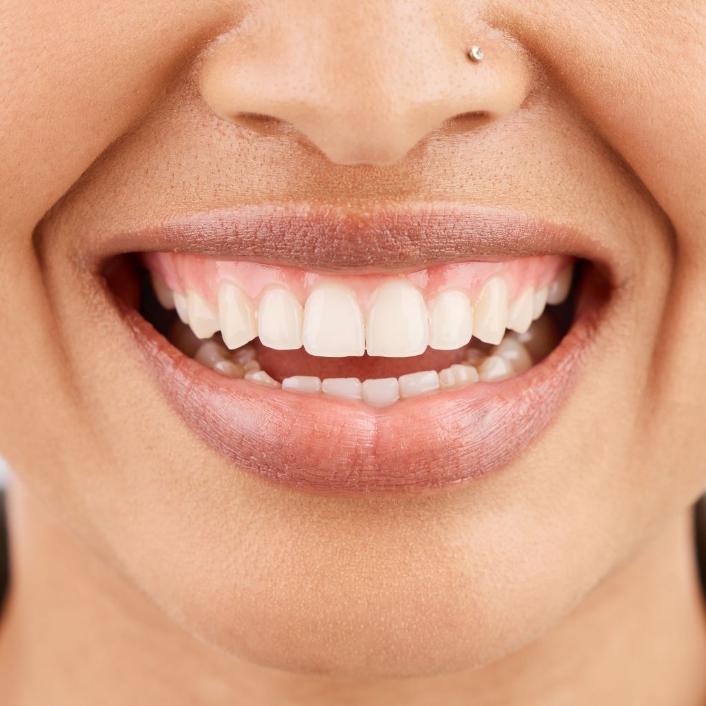 healthy gums woman image of a ct scan