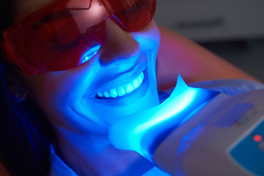 Teeth Whitening: Professional Treatments vs. Over-the-Counter