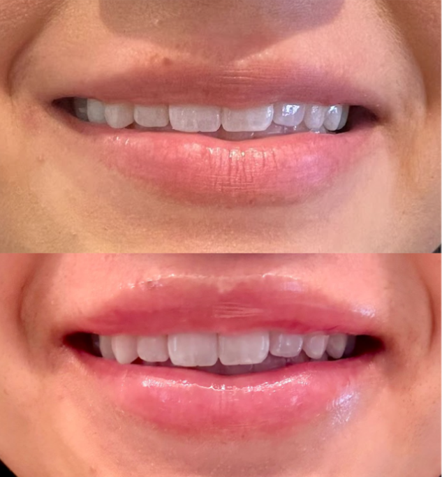 Woman covering face with hands