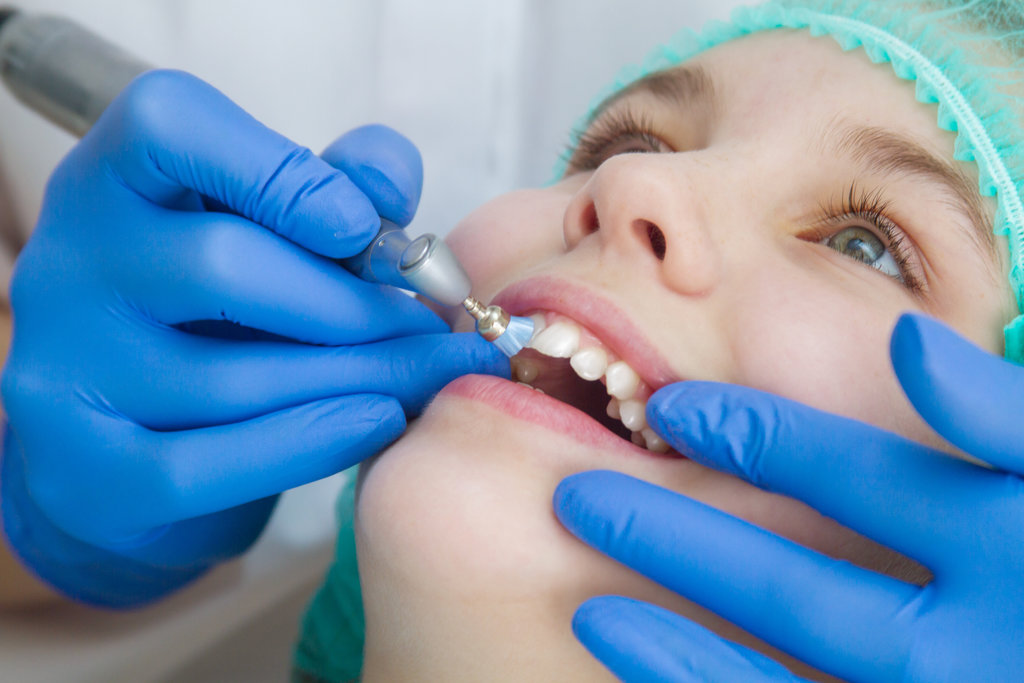 teeth whitening machine