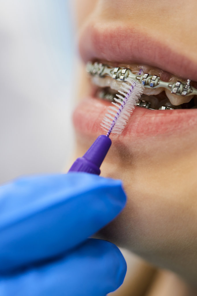 teeth whitening machine