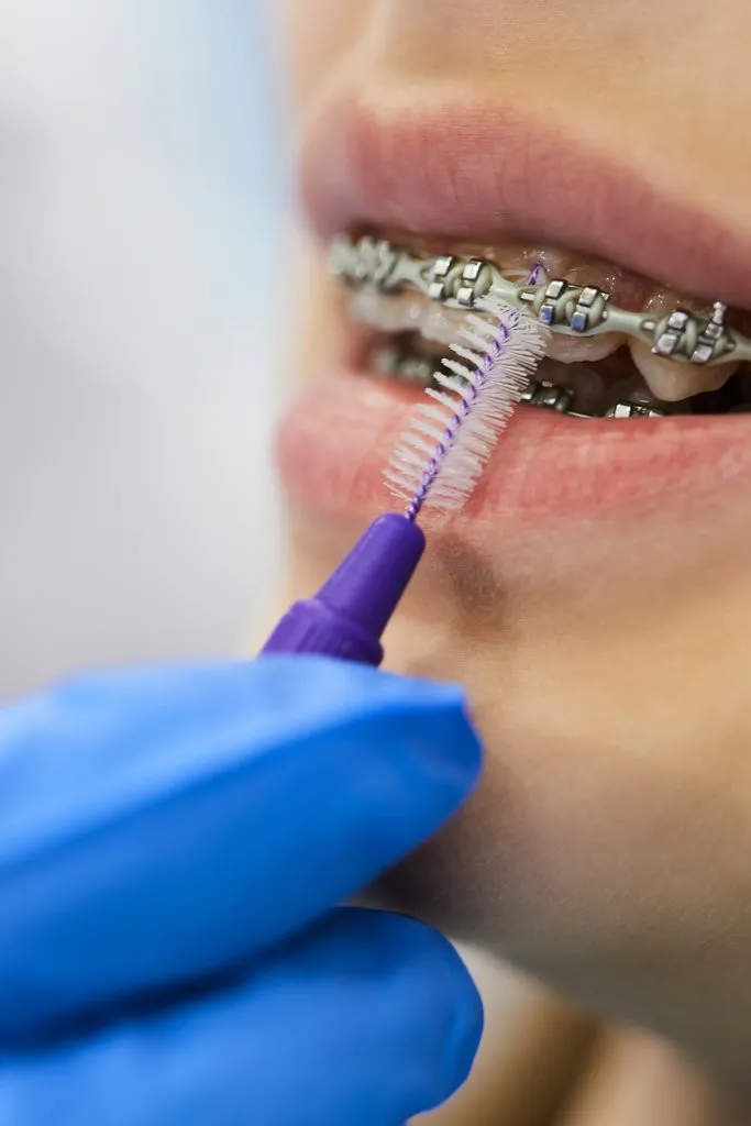 teeth whitening machine