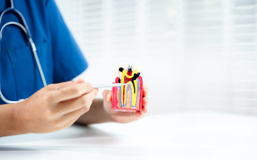 Can Root Canal Therapy Always Save Your Natural Tooth?