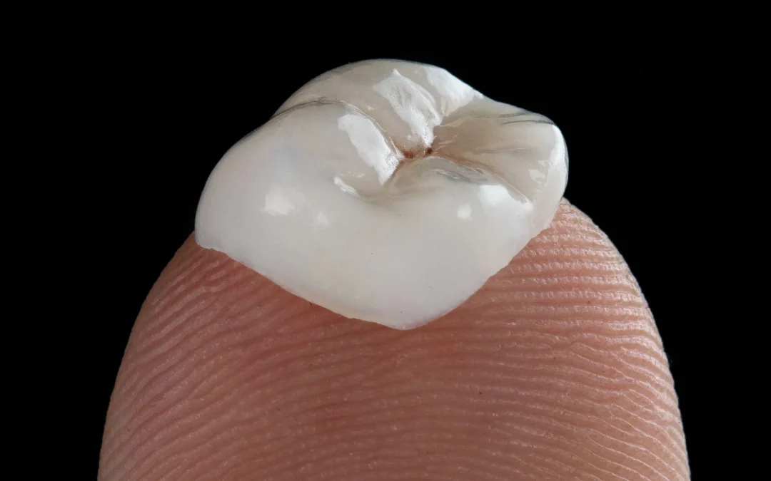 How a Single-Visit Inlay Compares to a Traditional Filling