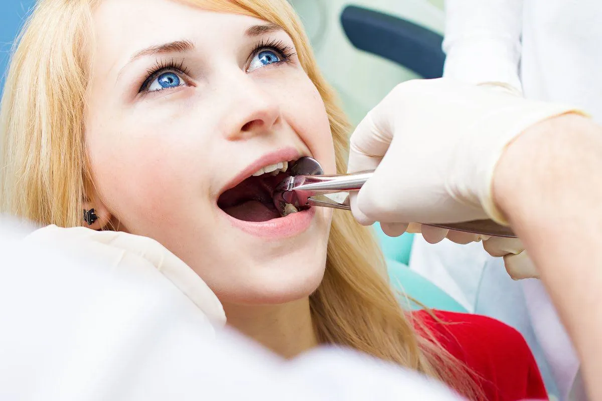Dentist pulling off wisdom tooth of a beautiful woman
